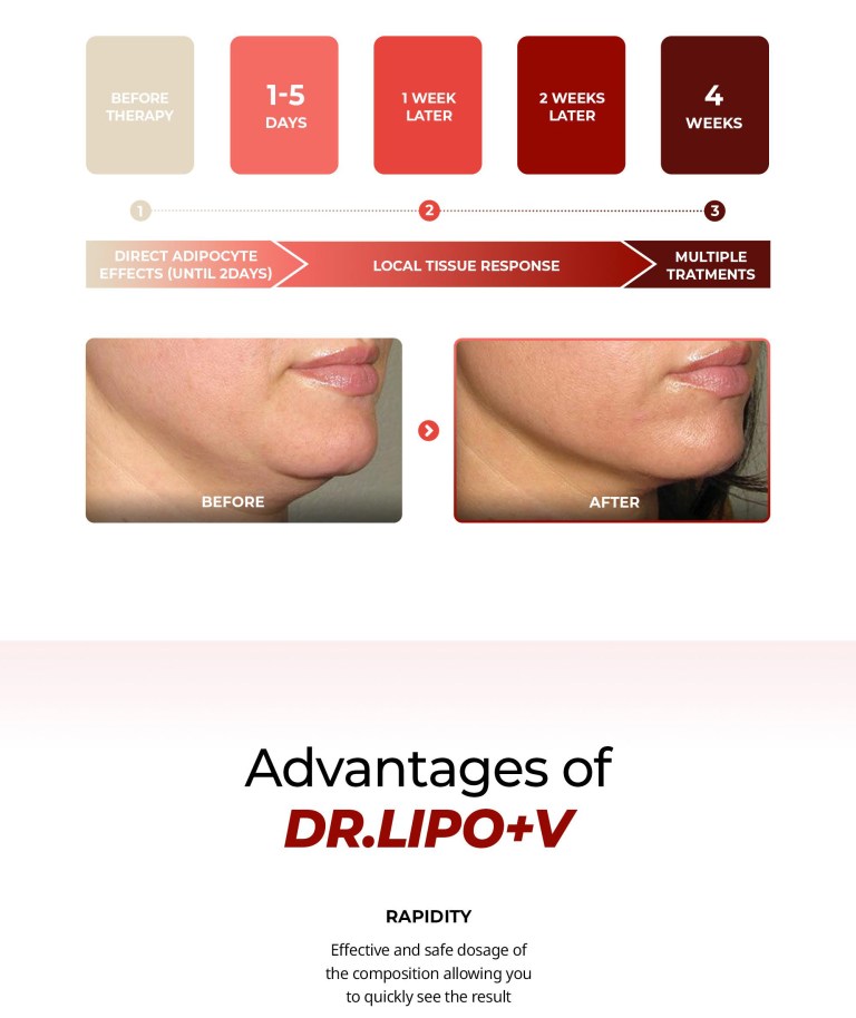 Dr. Lipo+ V (Face) - Image 9