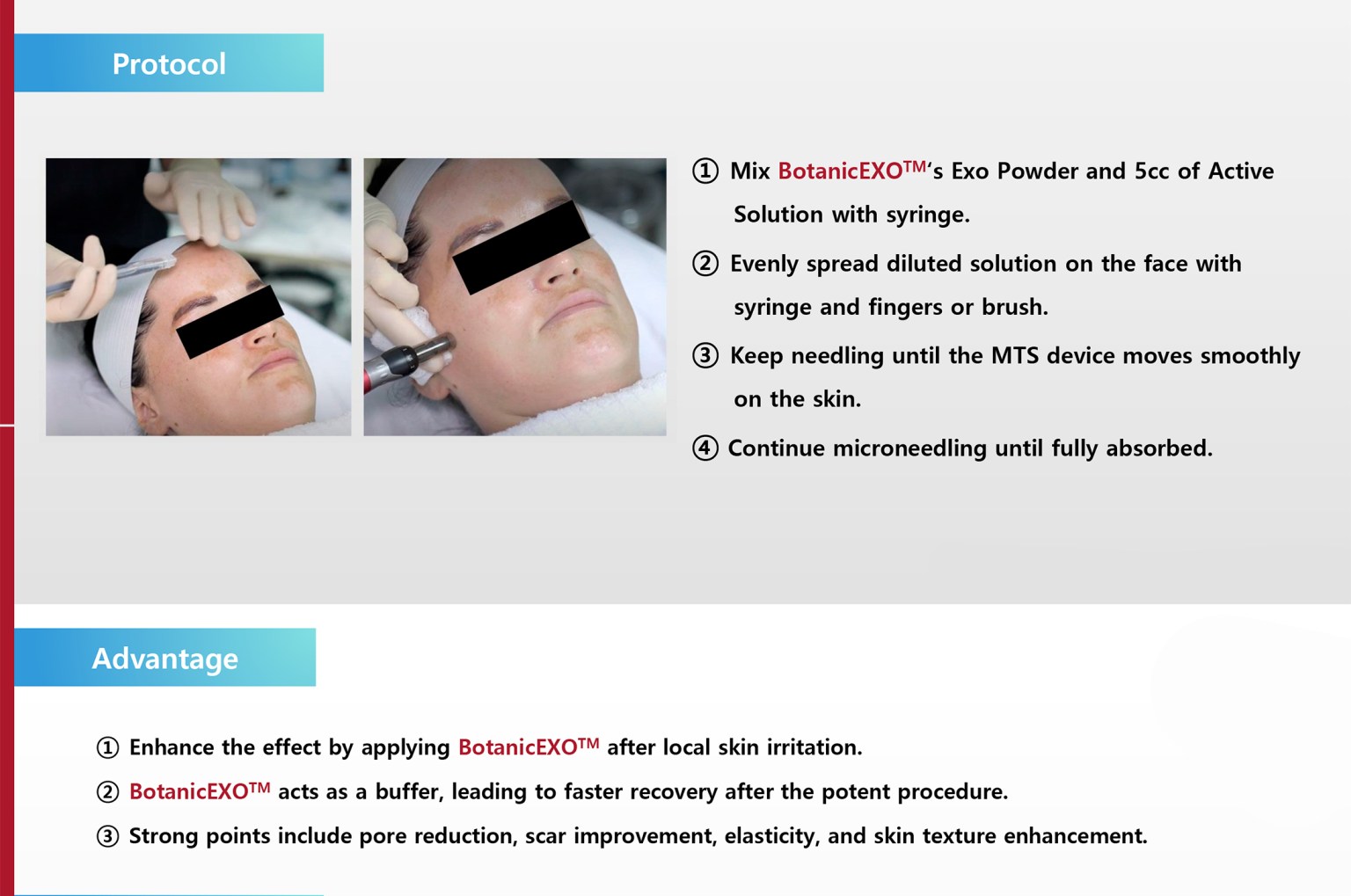 Botanic EXO - Image 4