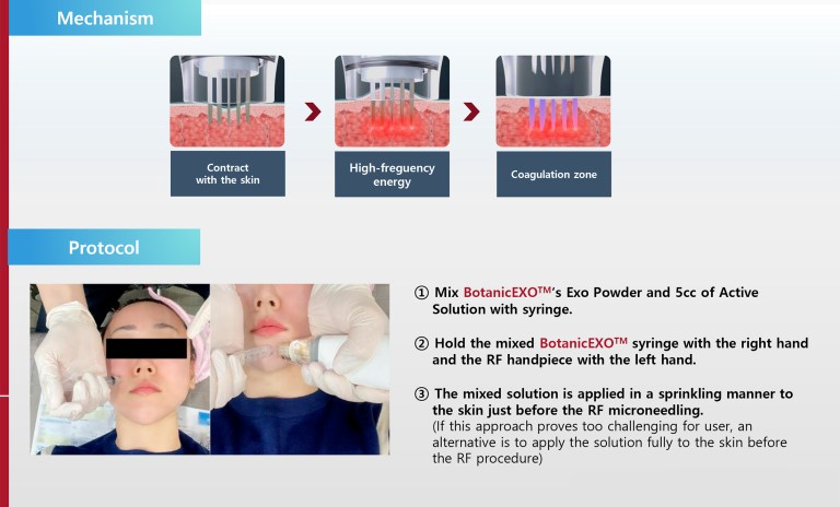 Botanic EXO - Image 5