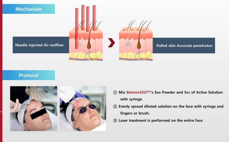 Botanic EXO - Image 8