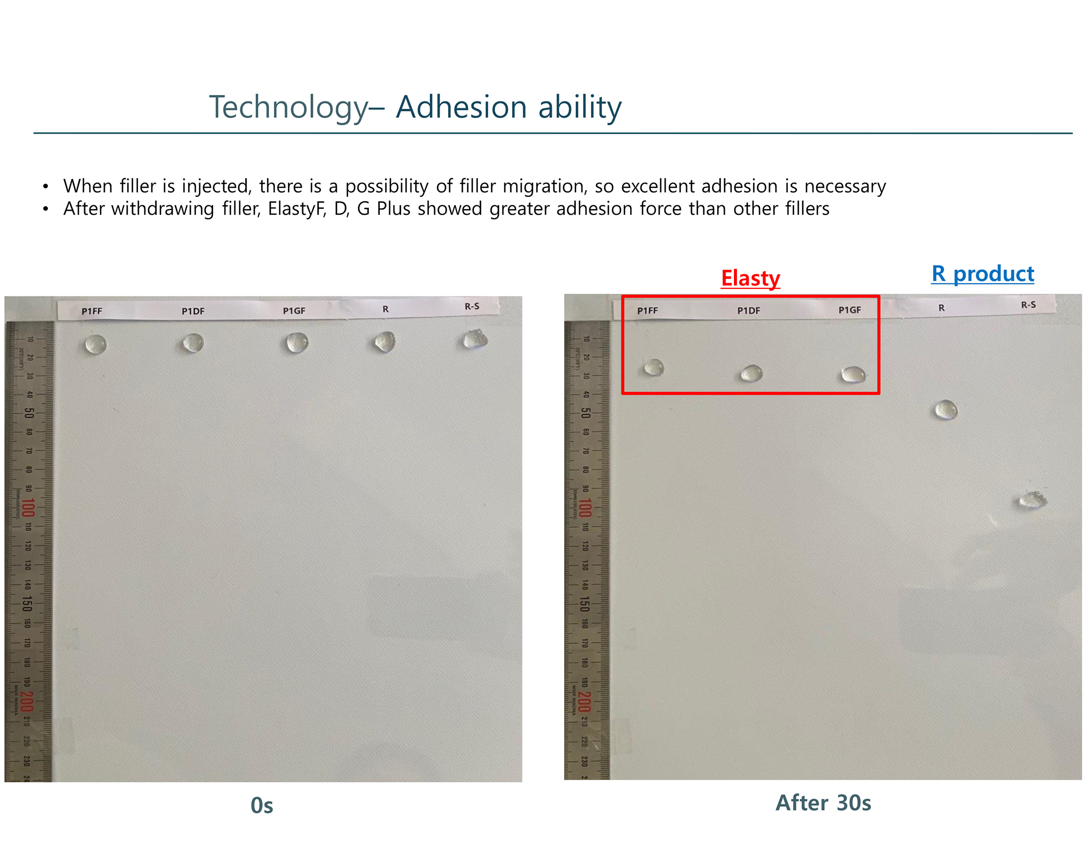 Elasty D Plus (1 syringe) - Image 12
